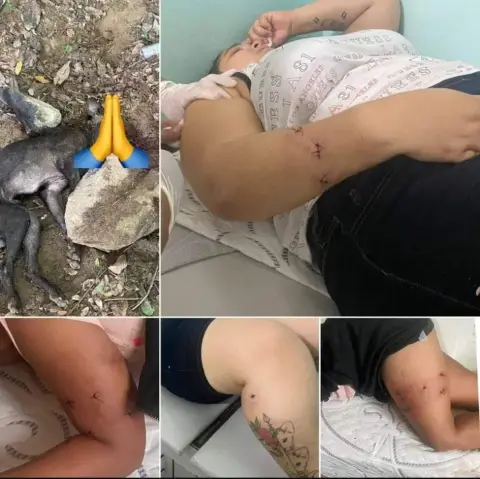 Perro pitbull ataca ferozmente a una madre y su hija en Loma de Cabrera, Dajabón