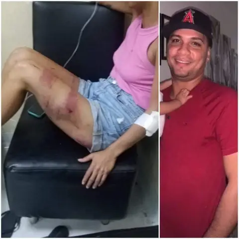 HOMBRE ATACA A SU MUJER DEJANDOLA EN ESTADO CRITICO