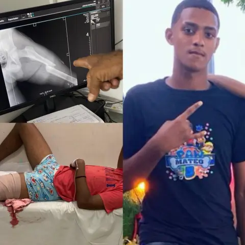 Joven Dajabonero, Sufrió un terrible accidente