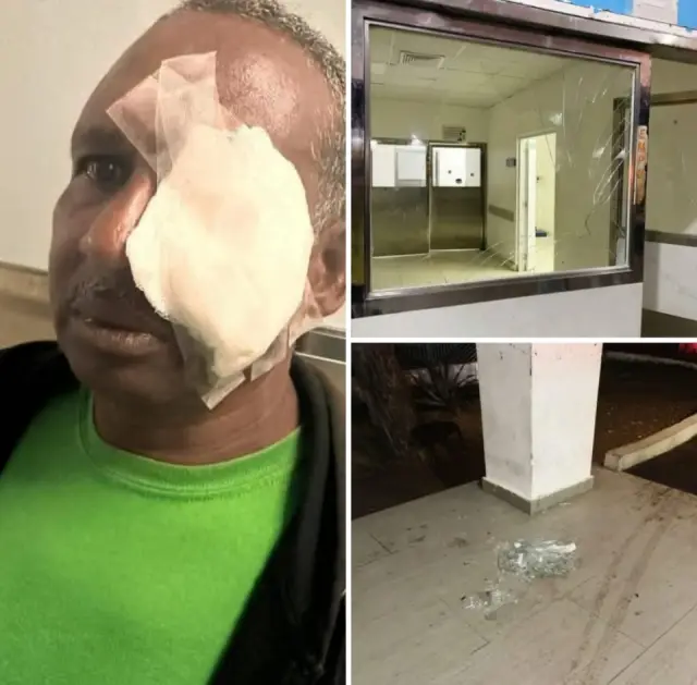 Policía pensionado en Montecristi en riesgo de perder visión tras ataque en Hospital.