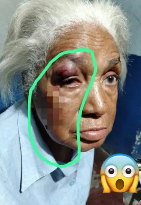 EN EL PUERTO DE VILLA ALTAGRACIA ENVEJECIENTE ES AGREDIDA FÍSICAMENTE TRAS PEDIR QUE DISMINUYERAN RUIDO EN “TETEO”