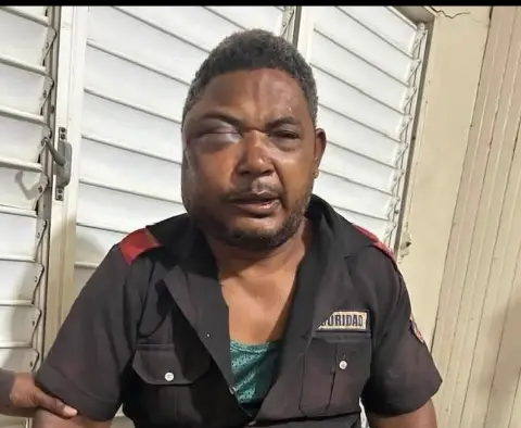 GUACHIMÁN RESULTA HERIDO TRAS SER ATRACADO