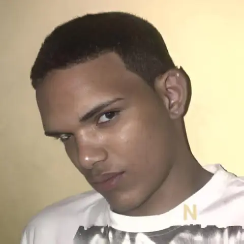 Joven pierde la mano tras brutal ataque en Las Colinas 1, San Pedro de Macorís