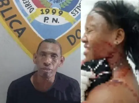 hombre agrede a su esposa con arma blanca.