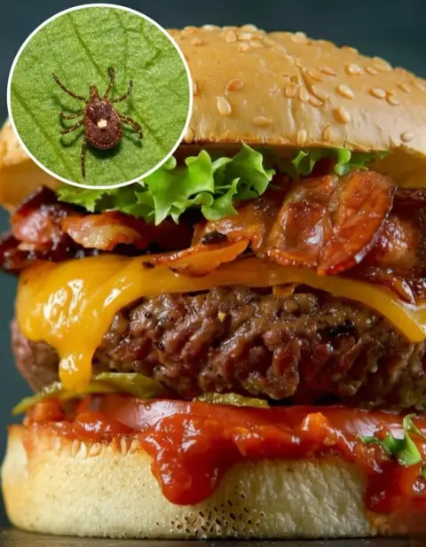 Muere hombre por comer hamburguesa por una alergia a la carne producida por garrapata