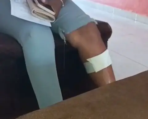 Maestra resulta herida al intentar detener pelea entre estudiantes en escuela