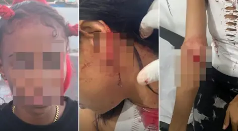 Dos mujeres resultan heridas durante riña  por disputa sentimental