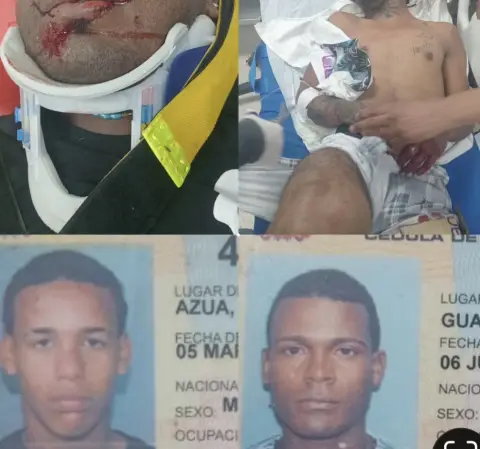 3 Heridos al chocar 2 motocicletas