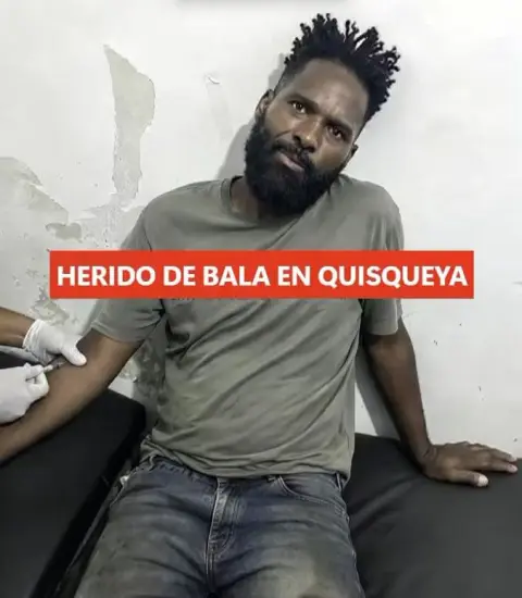 Hombre resulta herido quería comer en fritura sin pagar y con machete en mano😳